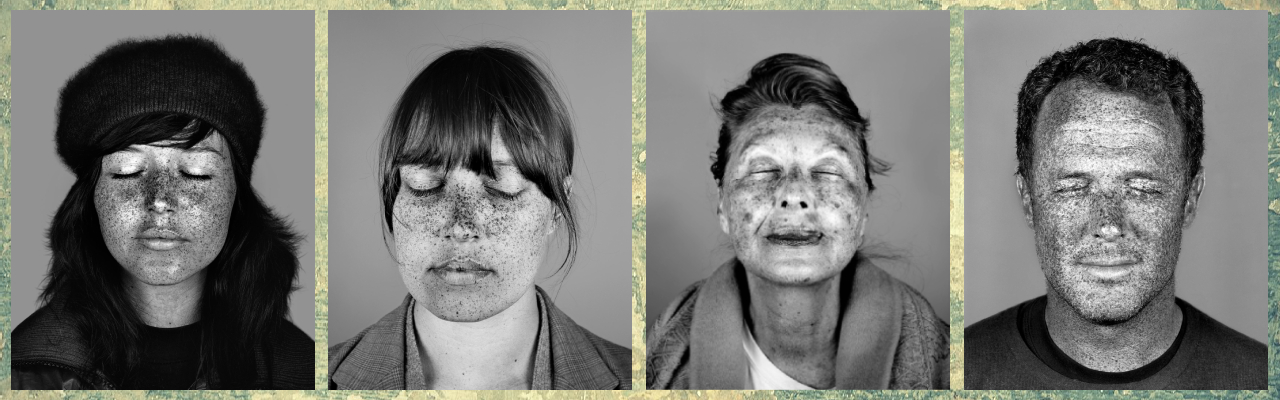 선크림 매일 바르지 않은 얼굴 예시 UV 초상화(UV portraits) -Cara Phillips.