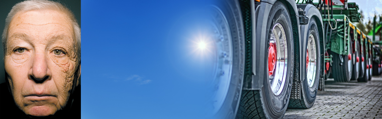 수십년간 선크림을 매일 바르지 않고 트럭 운전을 한 운전기사의 왼쪽 얼굴