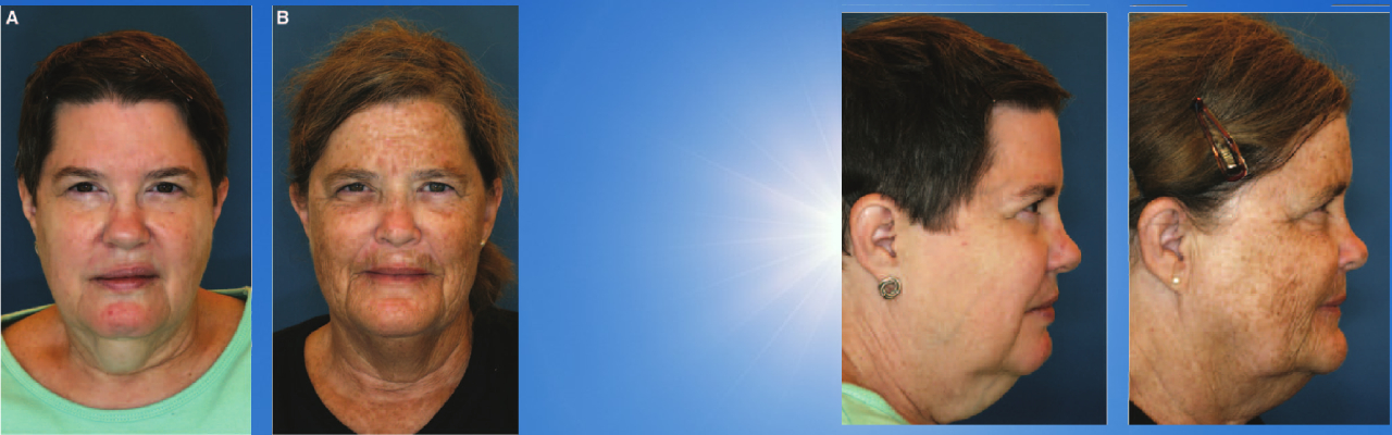 햇빛 노출에 상당한 차이가 있는 쌍둥이 사진